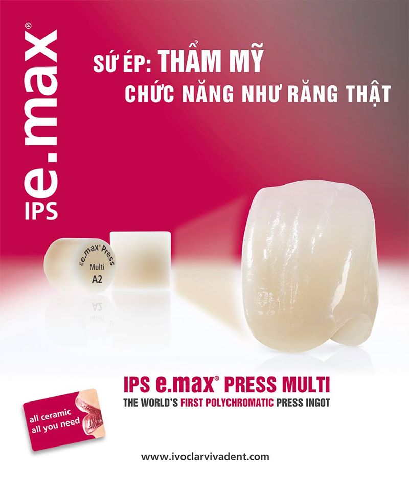 So sánh giữa sứ Emax và sứ Cercon